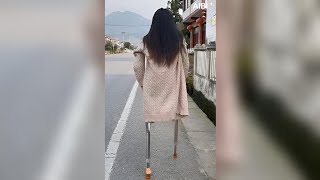 A Beautiful Girl With An Amputated Leg Walks With Crutches As Lightly As A Butterfly(3)#Amputee