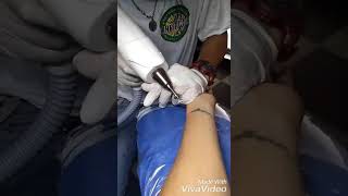 Tattoo Laser Removal Manila Philippines In Mabini Ink Tattoo And Tattoo Laser Removal