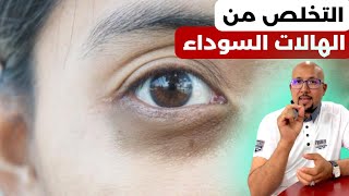 التخلص من الهالات السوداء | كحولية العين | الدكتور عماد ميزاب Docteur Imad Mizab
