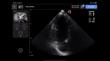 Handheld Ultrasound Review: KOSMOS by Echonous