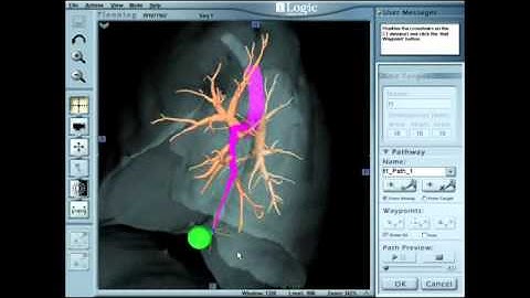 Marking the Target and Pathway Planning