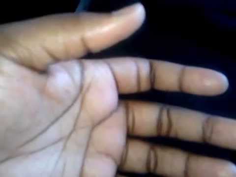 What are some causes of involuntary finger twitching?