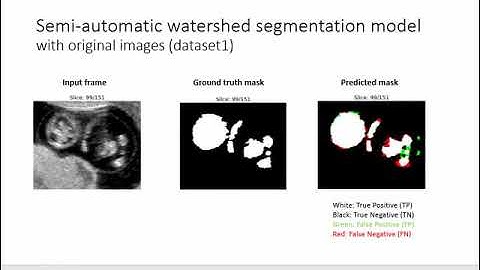 Semi-automatic watershed segmentation model with original input images (dataset1)