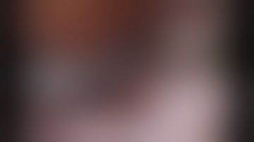 Robotic Right Lower Lobe Superior Segmentectomy - Intermediate