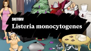 Listeria Monocytogenes: Infection Fundamentals (Full Lesson) | Sketchy Medical | USMLE Step 1