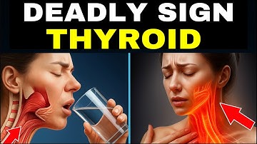 8 dodelijke schildkliersignalen die mensen missen tot het te laat is