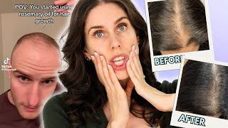 Does Rosemary Oil Actually Fix Baldness?! Is This TikTok Trend the Secret to Healthy Hair?