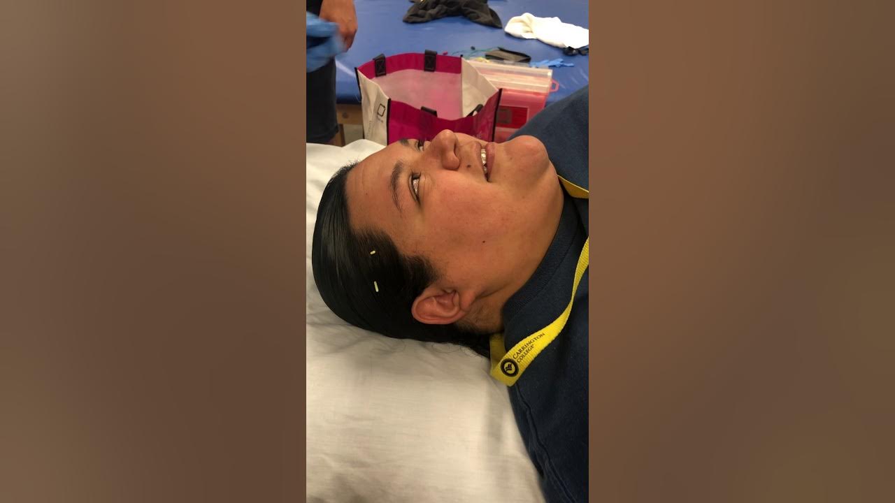 TMJ Dry Needling YouTube