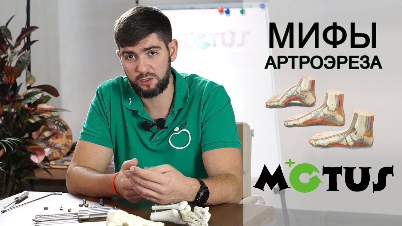 МОТУС ТЕСТ #6 | МИФЫ АРТРОЭРЕЗА