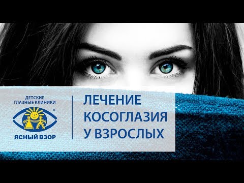 Косоглазие у взрослых. 😉 Успешное лечение косоглазия у взрослых! Ясный взор