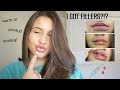 I GOT LIP FILLERS?! Everything you need to know + Before & Afters