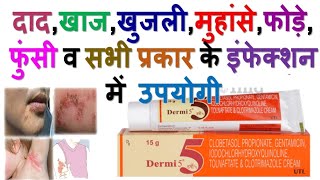 Dermi 5 Cream || dermi 5 cream uses in hindi ||दाद,खाज,खुजली की दवा || dad Khaj khujali Ki Dava