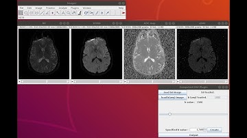 How to use the Computed DWI Imagej PlugIns ?