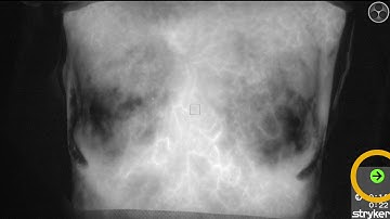 SPY QP - Inservice Video