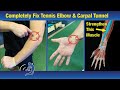 Fix Tennis Elbow in One Week - Exercises that Actually Work!