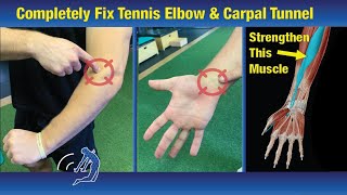 Fix Tennis Elbow in One Week  Exercises that Actually Work!