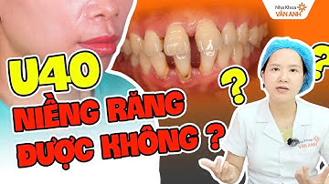U40 Niềng Răng Được Không? 3 Yếu Tố Quyết Định 90% Thành Công Khi Niềng Răng Cho Người Lớn Tuổi