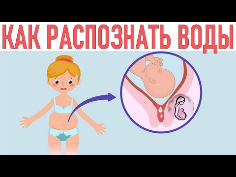 ОКОЛОПЛОДНЫЕ ВОДЫ ВО ВРЕМЯ БЕРЕМЕННОСТИ | Как выглядят околоплодные воды и как их распознать