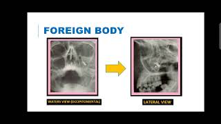 Object localization oral radiology