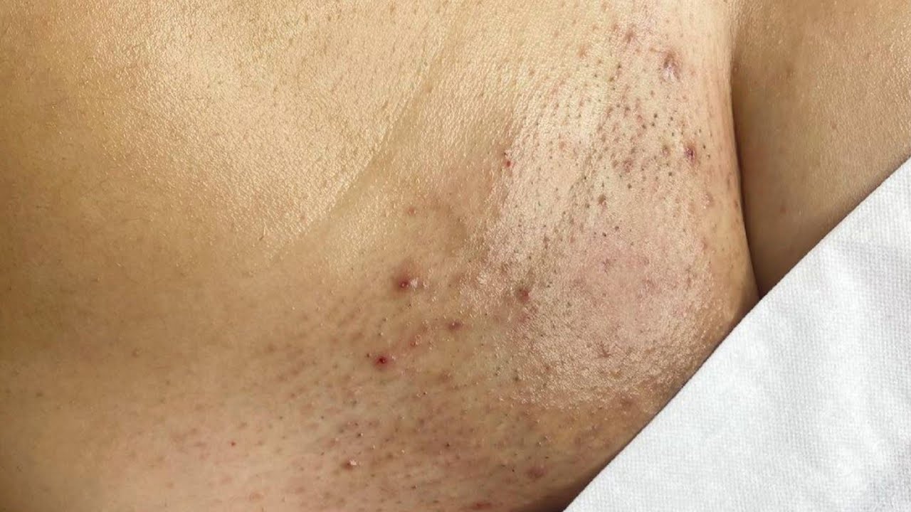 «Полное руководство по бразильской депиляции для женщин»: опыт удаления волос с помощью бразильск...