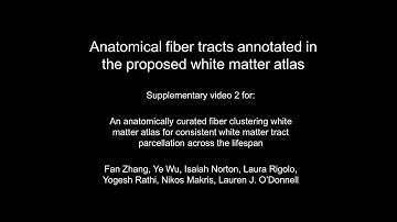 Anatomical Tracts from a Brain Diffusion MRI Tractography Atlas from 100 HCP Subjects