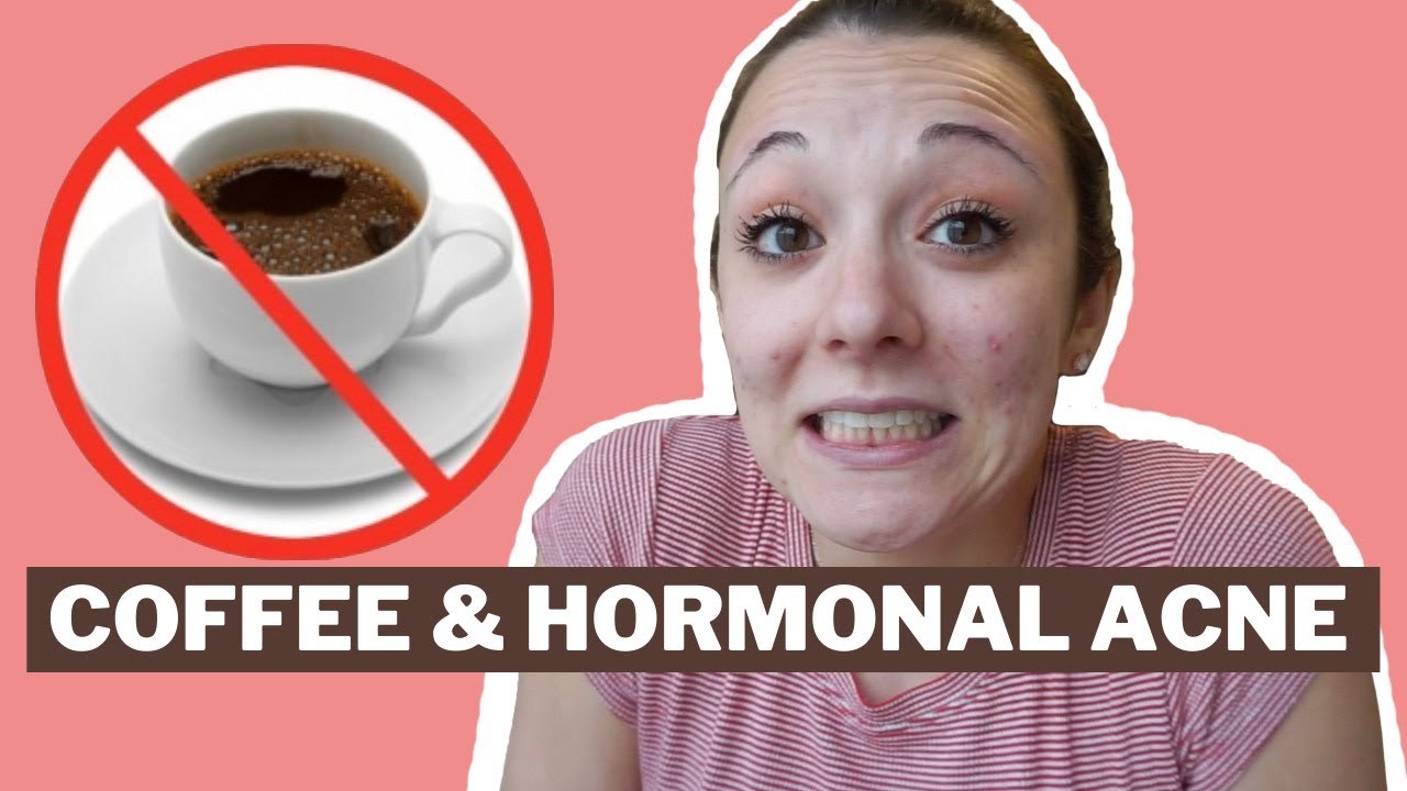 I QUIT COFFEE FOR 10 DAYS | TRYING TO CLEAR MY HORMONAL ACNE | Here's What Happened