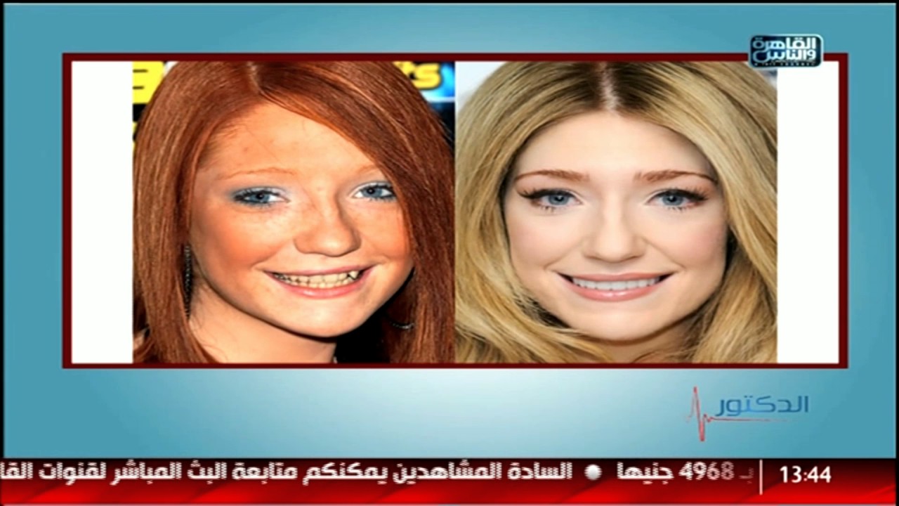 القاهرة والناس | اسباب فشل التركيبات الثابتة وزراعة الأسنان مع دكتور شادى على حسين فى الدكتور