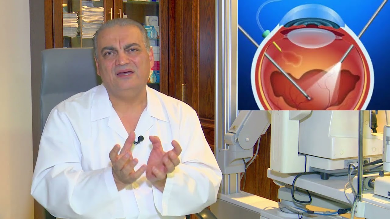 الدكتور وائل أبو ربيع يتحدث عن ظاهرة الذباب الطائر Floaters