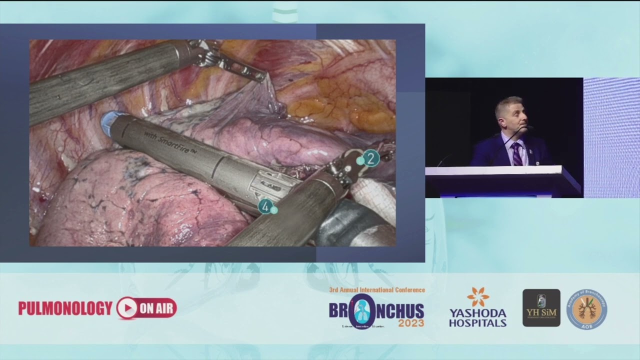 Fiducial Placement for Lung Resection | BRONCHUS 2023 | Yashoda Hospitals Hyderabad