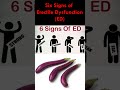 Six Signs of Erectile Dysfunction (ED) #Shorts