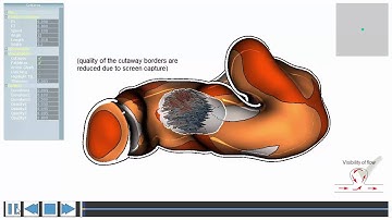 Occlusion-free Blood Flow Animation with Wall Thickness Visualization