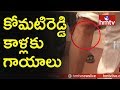 Komatireddy Injured by Marshalls: TS Assembly Budget Sessions 2018