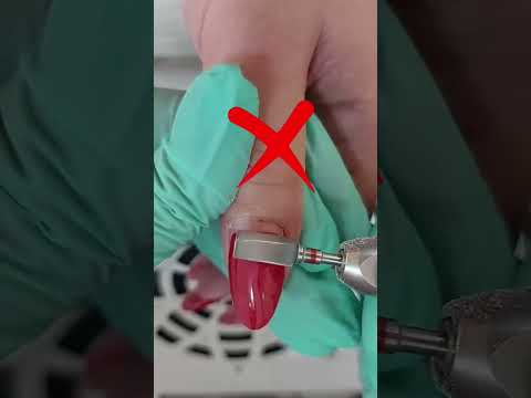 ریمو کردن ناخن نحوه صحیح ریمو ناخن سوهان