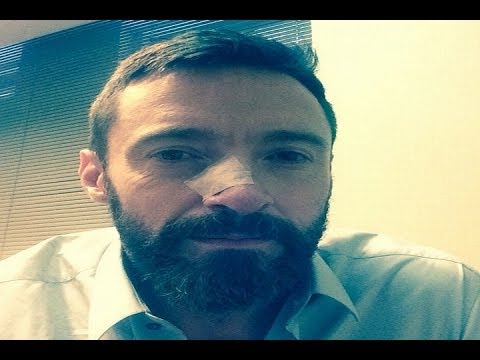 Un famoso actor de ‘X-Men’ revela que padece cáncer de mama: «Pensé en mantenerlo en secreto porque me daba vergüenza»