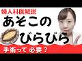 【産婦人科医解説】あそこのびらびらのカタチ、正常?異常? 治療は必要なケースとは? 徹底解説!【小陰唇の真実】