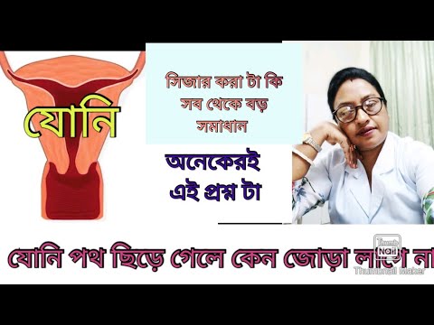 ভিডিও: সেলাই করার আগে আমার কি অনুভূতি ধুতে হবে?