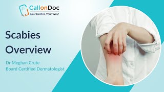 What Is Scabies?