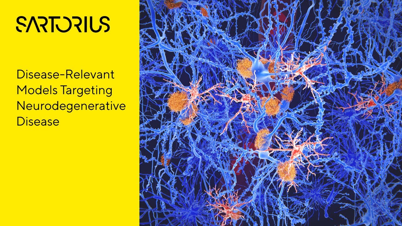 Incucyte® Webinar Preview: Live Cell Analysis of Human Neuron Glial Cell Co Cultures