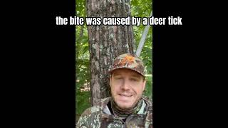 Let's Talk Tick Bites