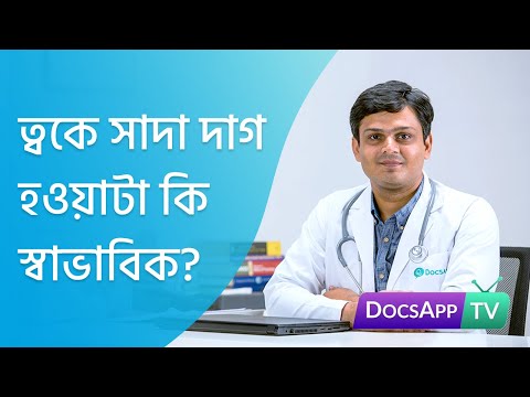 ভিডিও: সাদা উপর সাদা অপসারণ কিভাবে