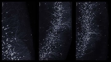 SmartSPIM Light Sheet Microscopy – High-Speed, High-Resolution Imaging for Whole Samples