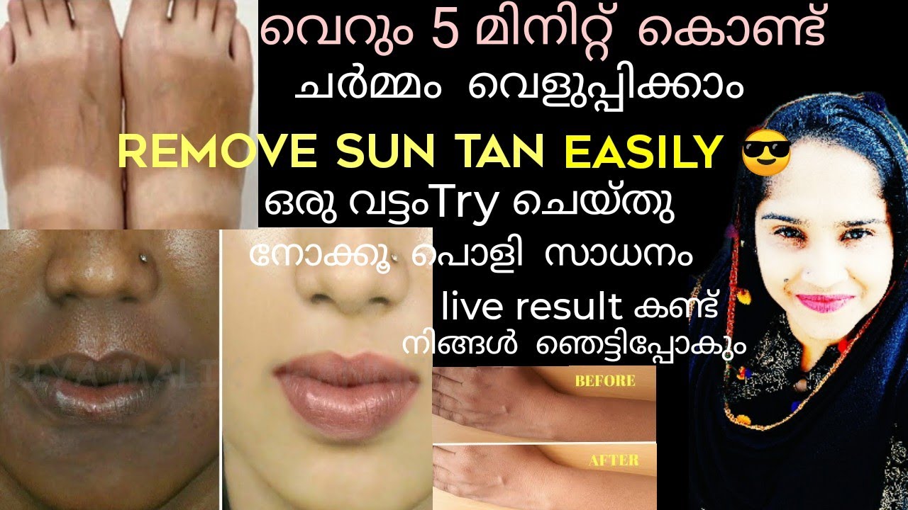 ചർമ്മത്തിലെ കറുപ്പ് തുടച്ച് മാറ്റാംചർമ്മം വെളുക്കാൻ😱suntan Remove