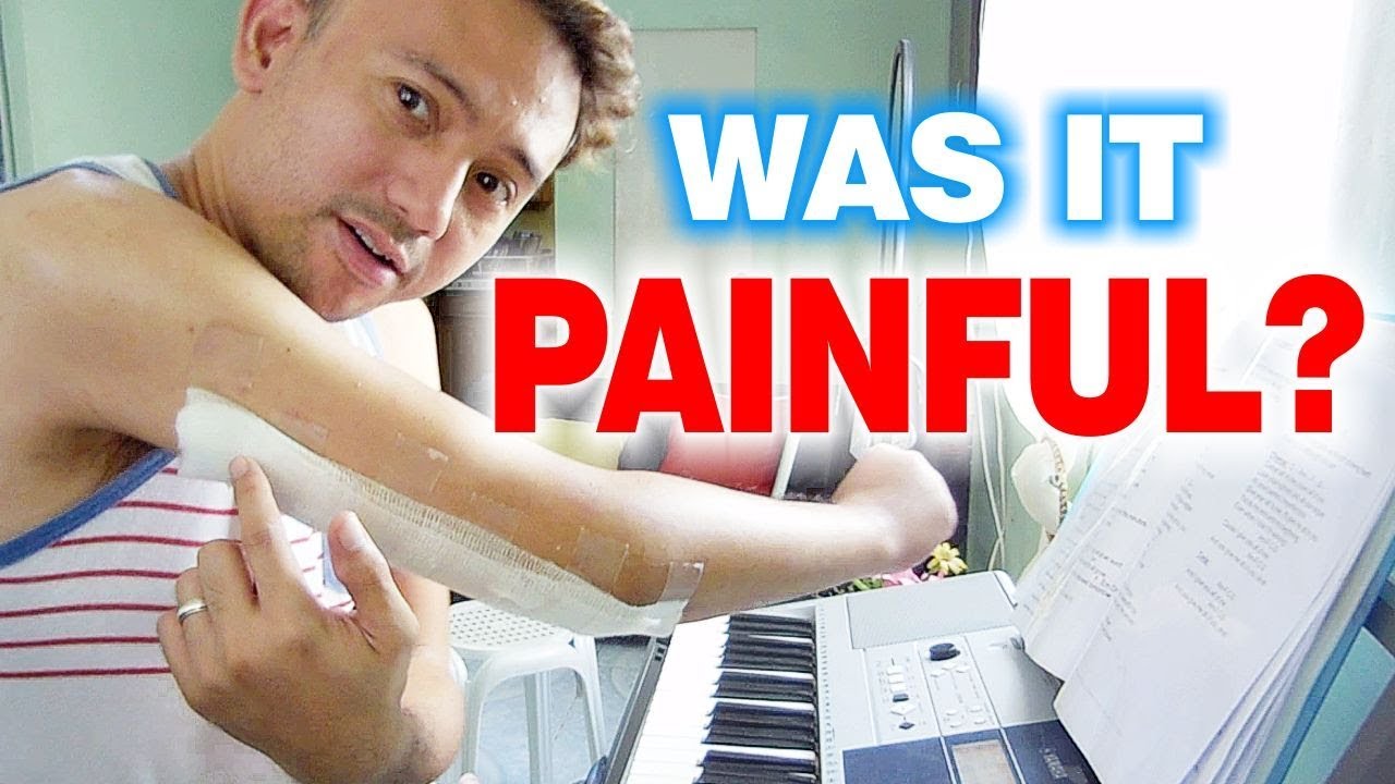 My Surgical Staples Removal Plus Home Physical Therapy Exercises For