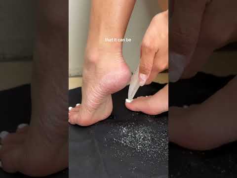 How I Solved My Dry Feet Problem 