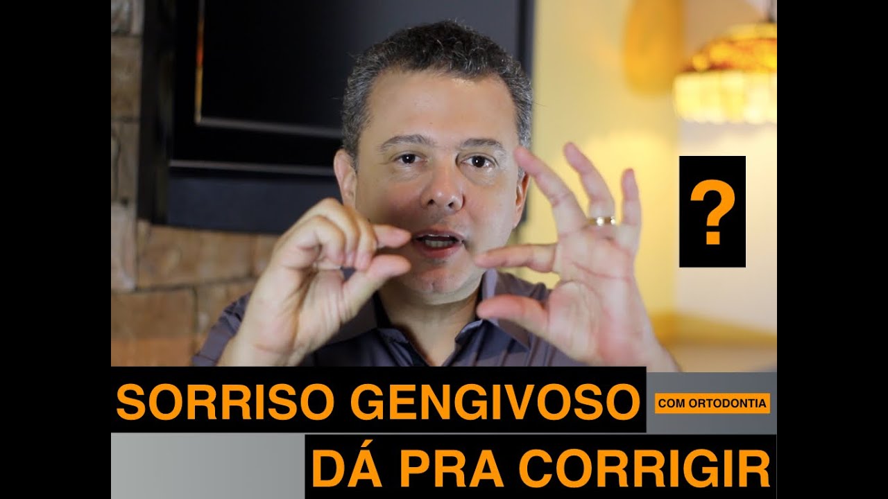 SORRISO GENGIVOSO, dá pra corrigir com ortodontia?OSO, dá pra corrigir com ortodontia?