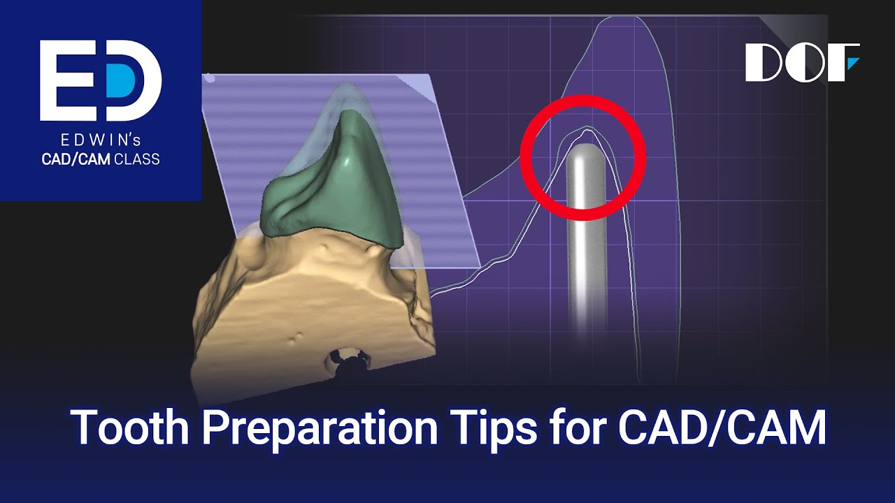 Tooth Preparation Tips for CAD/CAM - YouTube