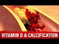 Vitamin D and Coronary Artery Calcification