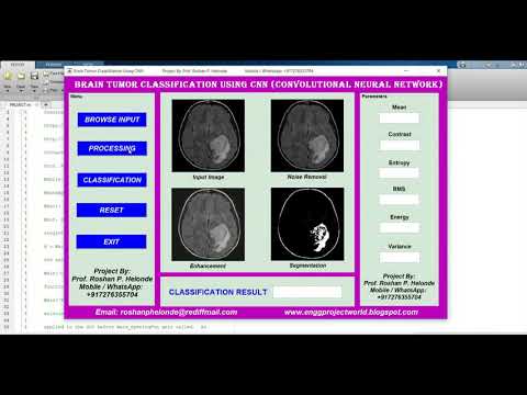 Brain Tumor Classification Using CNN | With Source Code | Matlab Project | Brain Tumor Detection