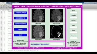 Brain Tumor Classification Using CNN | With Source Code | Matlab Project | Brain Tumor Detection