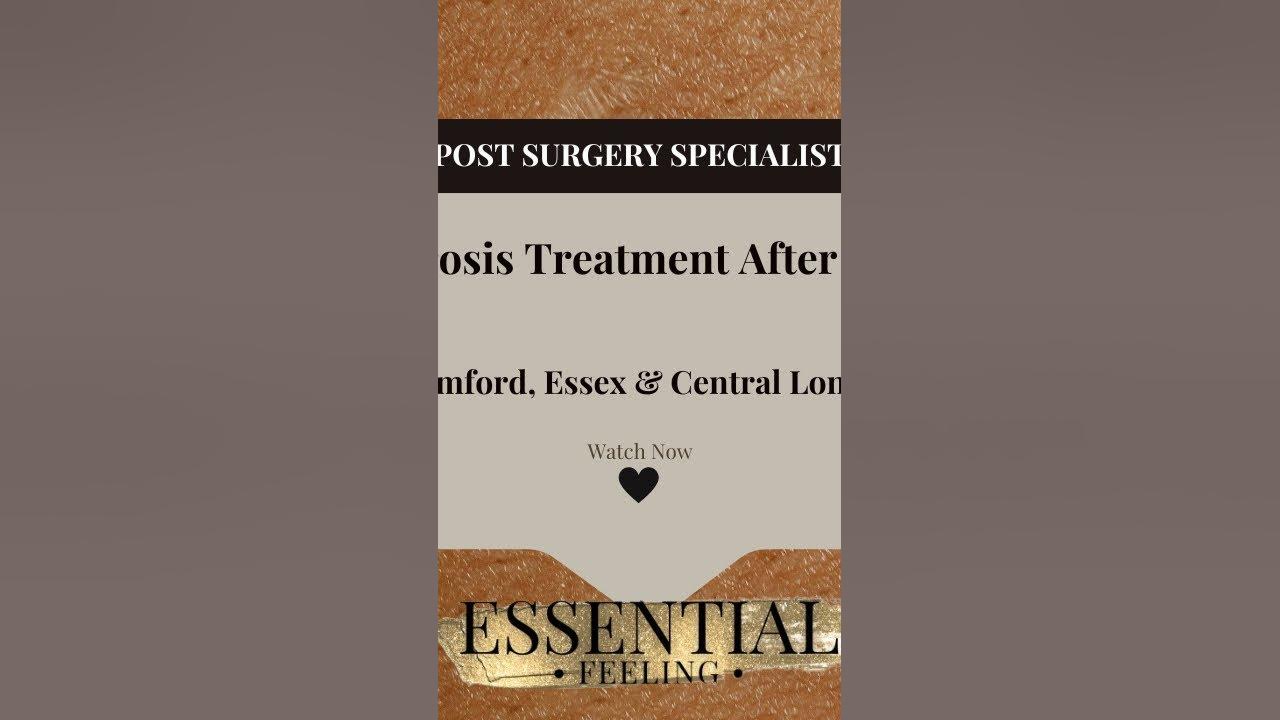 why-a-hard-stomach-after-lipo-why-is-my-stomach-hard-after-liposuction